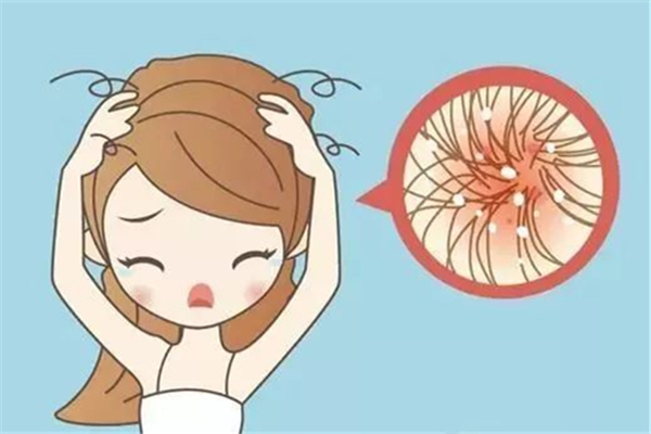 頭屑多是什么原因造成的 頭屑會(huì)影響頭發(fā)生長嗎