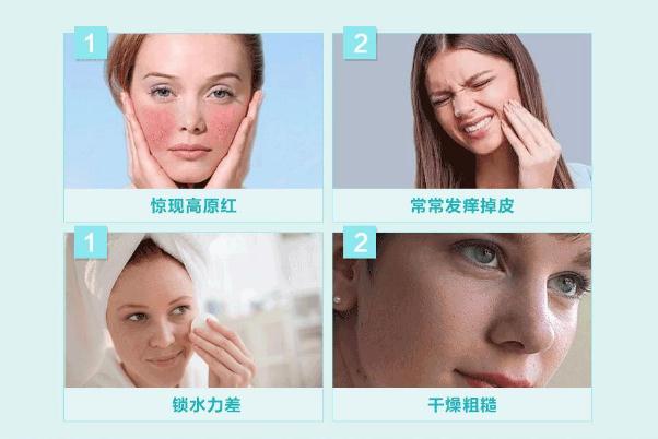 敏感肌怎樣修復成正常肌膚 敏感肌膚適合什么牌子的護膚品