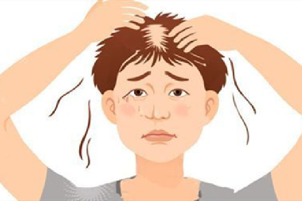 植發后能維持幾年 植發后要注意什么事項