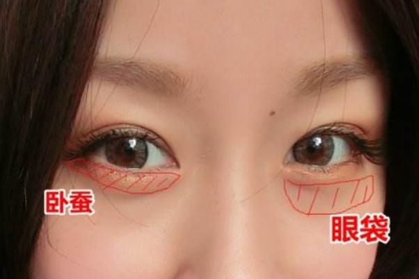 臥蠶和眼袋有什么區別 臥蠶眼的好處