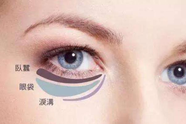 臥蠶和眼袋有什么區別 臥蠶眼的好處