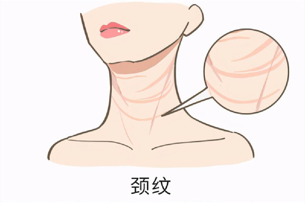 頸紋用開塞露有用嗎 頸紋用什么護膚品好