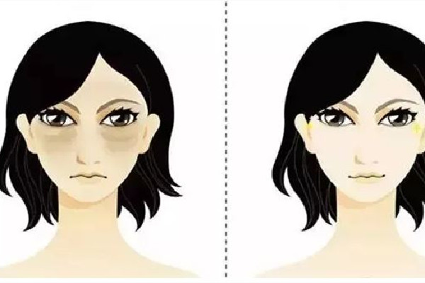 武漢哪家醫院眼袋手術做的好 武漢做眼袋手術價格