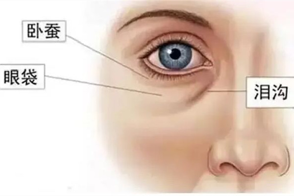 武漢哪家醫院去淚溝效果好 武漢去淚溝要花多少錢
